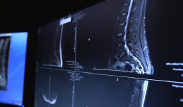3-D low-dose radiation screening